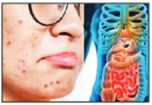 वेळीच ओळखा लक्षणे…